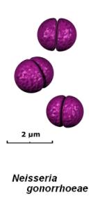 gram negative diplococci drawing